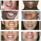 Business 1 image COST OF A DENTAL IMPLANT AND COST OF A DENTAL CROWN Wisdom Tooth Extraction in Sandton GP