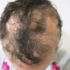 Business 2 image DR KATHERINE YORK Skin Specialists in Port Elizabeth EC