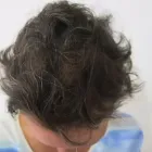 Business 5 image DR KATHERINE YORK Skin Specialists in Port Elizabeth EC