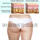 Business 6 image I-LIPO LAZER CENTRE Weight Loss Service in East London EC