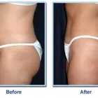 Business 8 image I-LIPO LAZER CENTRE Weight Loss Service in East London EC