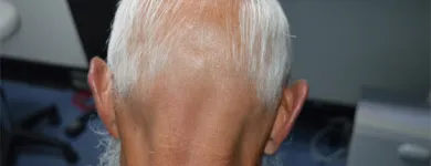 Maatskappy 1 beeld DR KATHERINE YORK Skin Specialists in Port Elizabeth EC