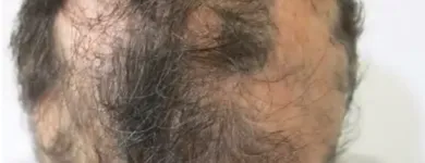 Maatskappy 2 beeld DR KATHERINE YORK Skin Specialists in Port Elizabeth EC