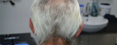 Maatskappy 3 beeld DR KATHERINE YORK Skin Specialists in Port Elizabeth EC