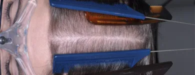 Maatskappy 4 beeld DR KATHERINE YORK Skin Specialists in Port Elizabeth EC