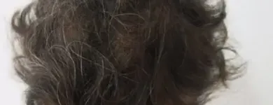 Maatskappy 5 beeld DR KATHERINE YORK Skin Specialists in Port Elizabeth EC